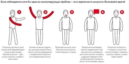 Масаж після інсульту в домашніх умовах техніка, ціни (інсульту) Масаж після інсульту в домашніх умовах техніка, ціни