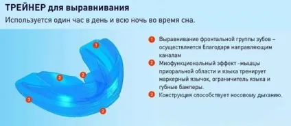 Виправлення кривих зубів - ефективні способи виправлення кривизни зубів (зубів) Виправлення кривих зубів - ефективні способи виправлення кривизни зубів