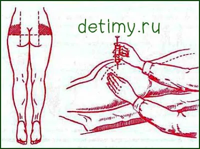 Як робити уколи правильно - поради медсестри (медсестри) Як робити уколи правильно - поради медсестри