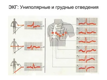 Як часто можна робити ЕКГ серця (можна) Як часто можна робити ЕКГ серця