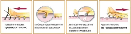 Як уникнути вростання волосся