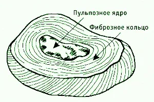Міжхребцева грижа у собак (дископатия) (собак хондродістрофоідних порід) Міжхребцева грижа у собак (дископатия)