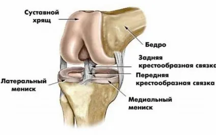 Меніскопатія колінного суглоба лікування і симптоми медіальної і літеральної форм (суглоба) Меніскопатія колінного суглоба лікування і симптоми медіальної і літеральної форм