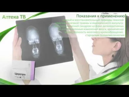 Медичні препарати та ліки від інсульту головного мозку лікування в домашніх умовах і (мозку) Медичні препарати та ліки від інсульту головного мозку лікування в домашніх умовах і
