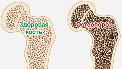 Який кальцій краще засвоюється, біологічно активні добавки компанії nsp (краще) Який кальцій краще засвоюється, біологічно активні добавки компанії nsp