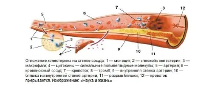 Як підвищити і відновити еластичність судин препарати, ліки і народні засоби (підвищити) Як підвищити і відновити еластичність судин препарати, ліки і народні засоби