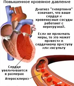 Як правильно виміряти артеріальний тиск приладами тонометром (вимірювання артеріального тиску) Як правильно виміряти артеріальний тиск приладами тонометром