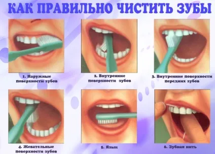 Як правильно чистити зуби (щіткою, ниткою) інструкція, фото (ниткою) Як правильно чистити зуби (щіткою, ниткою) інструкція, фото