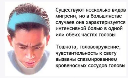 Мігрень, лікування