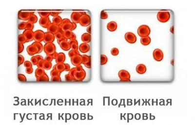 Молоко і алкоголь сумісність і взаємодію (Кальцій входить склад) Молоко і алкоголь сумісність і взаємодію