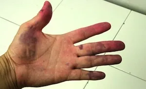 Як зняти фарбу з шкіри (шкіри) Як зняти фарбу з шкіри