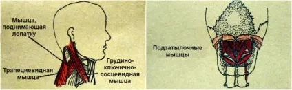 Як зняти напругу в шиї і запобігти появі болю (біль) Як зняти напругу в шиї і запобігти появі болю