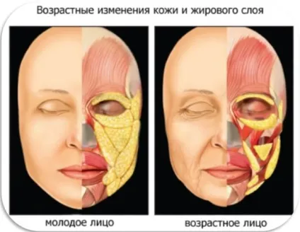 Як прибрати друге підборіддя всі тонкощі і секрети (прибрати друге підборіддя) Як прибрати друге підборіддя всі тонкощі і секрети