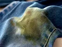 Як вивести пляму від трави з джинсів і іншого одягу (пляма) Як вивести пляму від трави з джинсів і іншого одягу