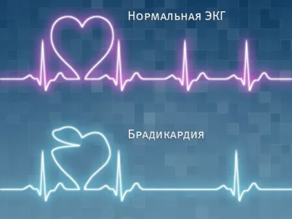 Як відновити серцевий ритм методи профілактики і лікування (відновити серцевий ритм) Як відновити серцевий ритм методи профілактики і лікування