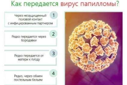 Чи може папілома пройти сама