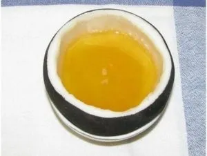 Камені в сечоводі лікування народними засобами (лікування) Камені в сечоводі лікування народними засобами