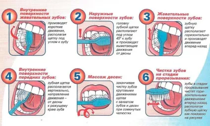 Карієс та його профілактика в дітей раннього віку (карієс) Карієс та його профілактика в дітей раннього віку