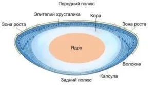 Катаракта - причини і симптоми