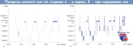Клініка і діагностика розладів сну (розладів) Клініка і діагностика розладів сну