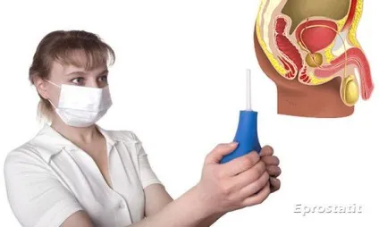 Клізми при простатиті - склад і рецепти розчинів (дія загальносистемних препаратів) Клізми при простатиті - склад і рецепти розчинів