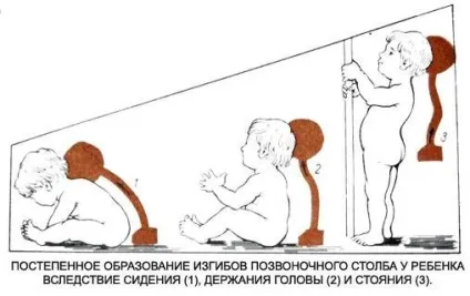 Порушення постави у дітей причини, профілактика, лікування, вправи (дітей) Порушення постави у дітей причини, профілактика, лікування, вправи