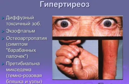 Корінь білої перстачу - застосування і лікування щитовидної залози Ендонормом, травами (перстачу) Корінь білої перстачу - застосування і лікування щитовидної залози Ендонормом, травами