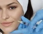 Корекція опущених куточків губ гіалуроновою кислотою, гіалуронова кислота (куточків) Корекція опущених куточків губ гіалуроновою кислотою, гіалуронова кислота
