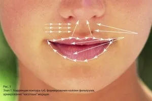 Красиві губки - це успіх! Г