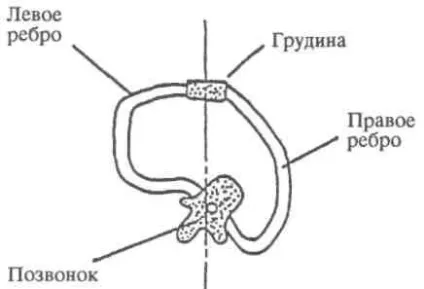 Хрест ортопедії на реберном горбі, з