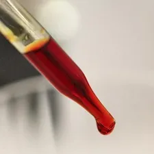Кт скроневих кісток, опис, що показує комп'ютерна томографія скроневих кісток, ціна процедури (опис) Кт скроневих кісток, опис, що показує комп'ютерна томографія скроневих кісток, ціна процедури