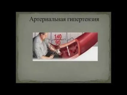 Купірування гіпертонічного кризу які препарати застосовують (які) Купірування гіпертонічного кризу які препарати застосовують