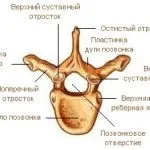Лікування артрозу плюсневого суглоба (лікування) Лікування артрозу плюсневого суглоба