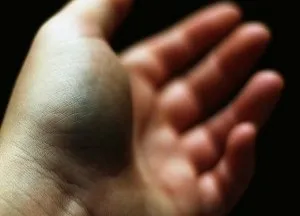 Лікування циститу у жінок і чоловіків народними засобами в домашніх умовах (лікування циститу народними засобами в домашніх умовах) Лікування циститу у жінок і чоловіків народними засобами в домашніх умовах