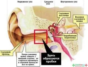 Лікування нейросенсорної приглухуватості народними засобами відгуки (гостра нейросенсорна туговухість лікування) Лікування нейросенсорної приглухуватості народними засобами відгуки