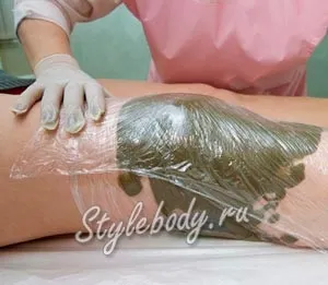 Лікування псоріазу і його профілактика (лікування) Лікування псоріазу і його профілактика