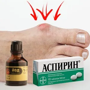 Лікування шишки на нозі біля великого пальця (біля) Лікування шишки на нозі біля великого пальця