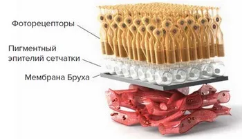 Лікування вікової макулярної дегенерації (Вікова макулярна дегенерація) Лікування вікової макулярної дегенерації