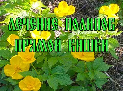 Лікування поліпів прямої кишки - ефективне лікування чистотілом, лікування в домашніх умовах (кишки) Лікування поліпів прямої кишки - ефективне лікування чистотілом, лікування в домашніх умовах