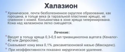 Лікування халязиона у дитини - причини, симптоми і способи видалення у дітей (симптоми) Лікування халязиона у дитини - причини, симптоми і способи видалення у дітей