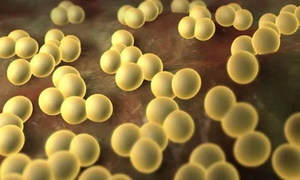 Лікування стафілококових бактеріофагів при золотистому стафілококу (стафілококовим) Лікування стафілококових бактеріофагів при золотистому стафілококу
