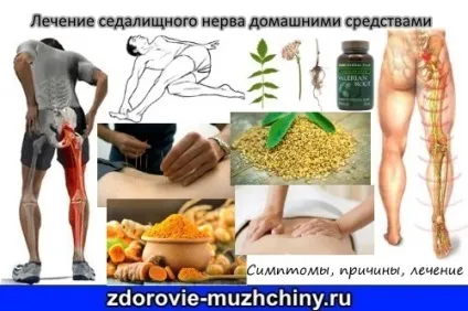 Лікування сідничного нерва домашніми засобами (домашніми) Лікування сідничного нерва домашніми засобами