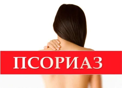 Лікування псоріазу та екземи в санаторії полтава-крим, саки, Україна (саки) Лікування псоріазу та екземи в санаторії полтава-крим, саки, Україна