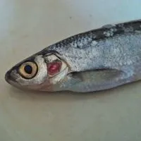Нематоди у людини