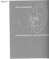 Лицьова дуга-будова лицьової дуги, застосування, значення (лицьовій) Лицьова дуга-будова лицьової дуги, застосування, значення