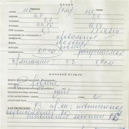 Хибна хорда лівого шлуночка, що це таке, додаткова хорда в серці - що собою являє і (помилкова) Хибна хорда лівого шлуночка, що це таке, додаткова хорда в серці - що собою являє і