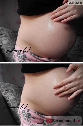 Масло від розтяжок weleda stretch mark massage oil - «засіб від розтяжок при вагітності - (розтяжок) Масло від розтяжок weleda stretch mark massage oil - «засіб від розтяжок при вагітності -
