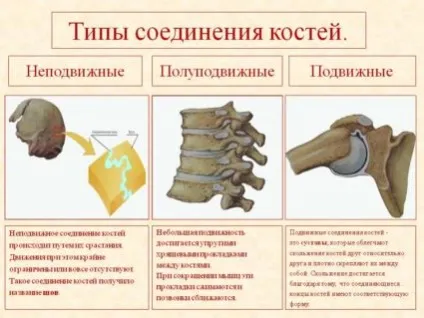 Нерухоме з'єднання кісток типи з'єднання (типи) Нерухоме з'єднання кісток типи з'єднання