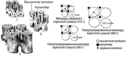 Міокардіальна форма серцевої недостатності - лікування серця (скорочувальної функції серця) Міокардіальна форма серцевої недостатності - лікування серця