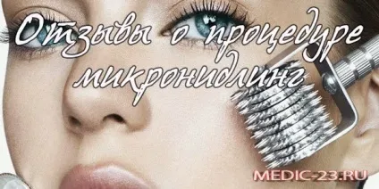 Мікронідлінг відгуки про процедуру, оцінка результату, безпеку проведення
